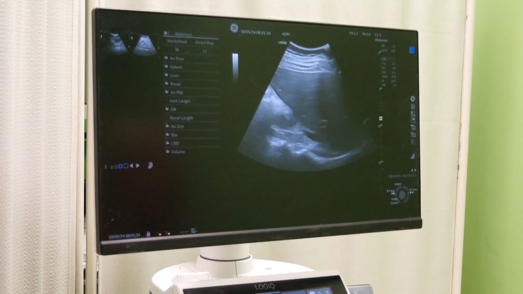 Značaj preventivnog pregleda muškaraca